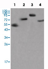 Western Blot (Recombinant protein)