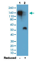 Western Blot