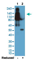 Western Blot