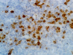 Immunohistochemistry (Formalin/PFA-fixed paraffin-embedded sections)