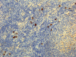 Immunohistochemistry (Formalin/PFA-fixed paraffin-embedded sections)