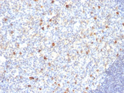 Immunohistochemistry (Formalin/PFA-fixed paraffin-embedded sections)