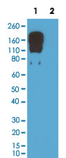 Western Blot