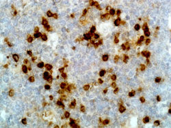 Immunohistochemistry (Formalin/PFA-fixed paraffin-embedded sections)