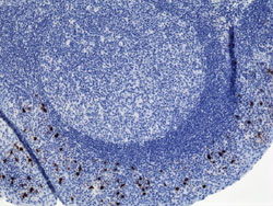 Immunohistochemistry (Formalin/PFA-fixed paraffin-embedded sections)