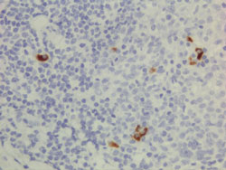 Immunohistochemistry (Formalin/PFA-fixed paraffin-embedded sections)