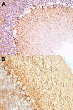 Immunohistochemistry (Formalin/PFA-fixed paraffin-embedded sections)