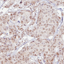 Immunohistochemistry (Formalin/PFA-fixed paraffin-embedded sections)