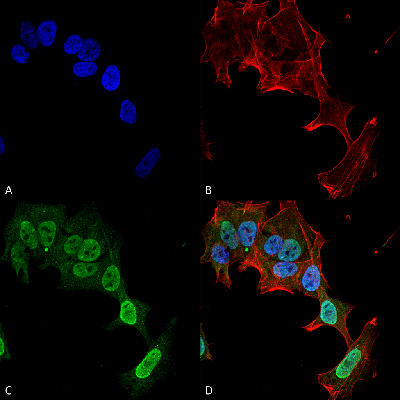 Immunocytochemistry