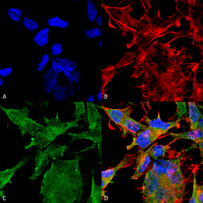 Immunocytochemistry