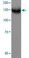 Western Blot (Tissue lysate)