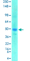 Western Blot (Tissue lysate)