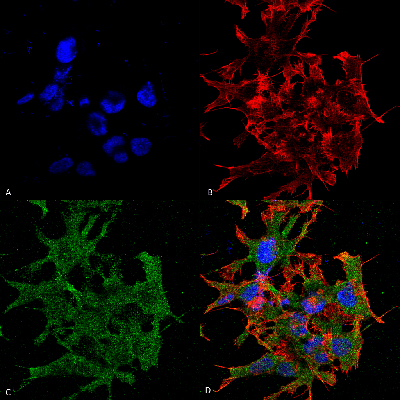 Immunocytochemistry