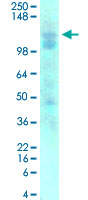 Western Blot (Tissue lysate)