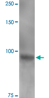 Western Blot (Tissue lysate)