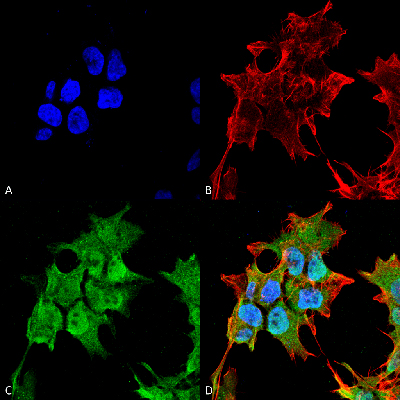 Immunocytochemistry