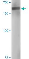 Western Blot (Tissue lysate)