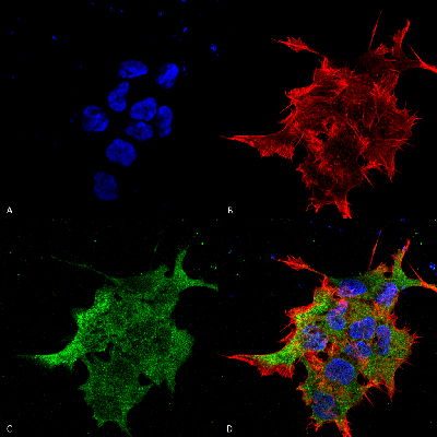 Immunocytochemistry