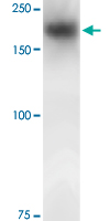 Western Blot (Tissue lysate)