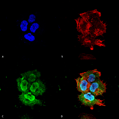 Immunocytochemistry