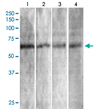 Western Blot (Tissue lysate)