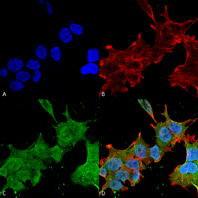 Immunocytochemistry