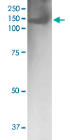 Western Blot (Tissue lysate)