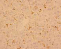 Immunohistochemistry