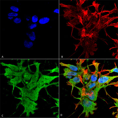 Immunocytochemistry