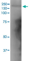 Western Blot (Tissue lysate)