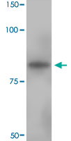 Western Blot (Tissue lysate)