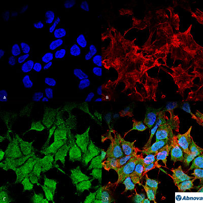 Immunocytochemistry