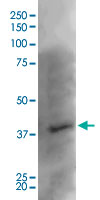 Western Blot (Tissue lysate)