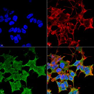 Immunocytochemistry