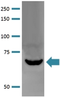 Western Blot (Tissue lysate)