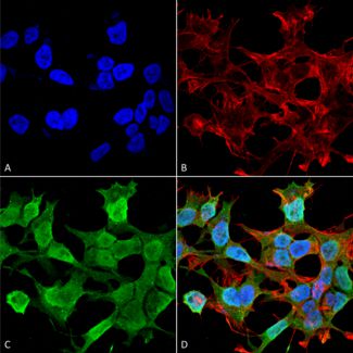 Immunocytochemistry