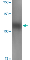 Western Blot (Tissue lysate)