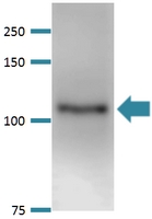 Western Blot (Tissue lysate)