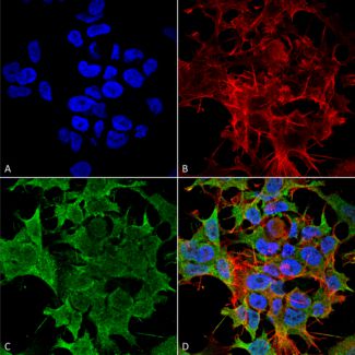 Immunocytochemistry