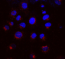 Immunocytochemistry