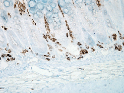 Immunohistochemistry (Formalin/PFA-fixed paraffin-embedded sections)