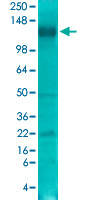 Western Blot (Tissue lysate)