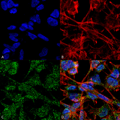 Immunocytochemistry