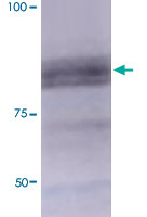 Western Blot (Tissue lysate)