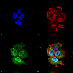 Immunocytochemistry