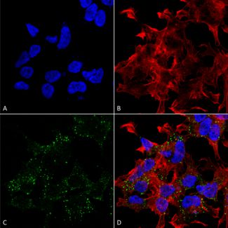 Immunocytochemistry