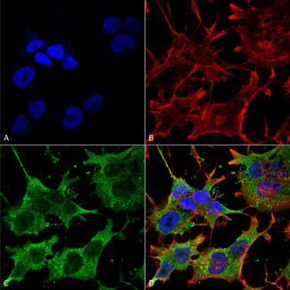 Immunocytochemistry