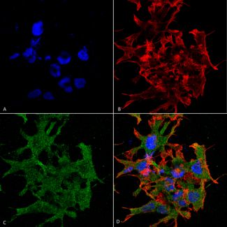 Immunocytochemistry