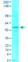 Western Blot (Tissue lysate)