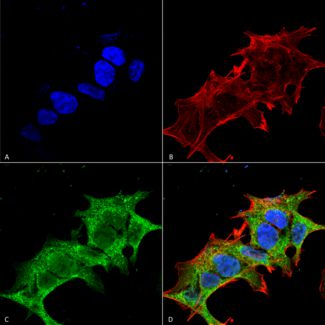 Immunocytochemistry